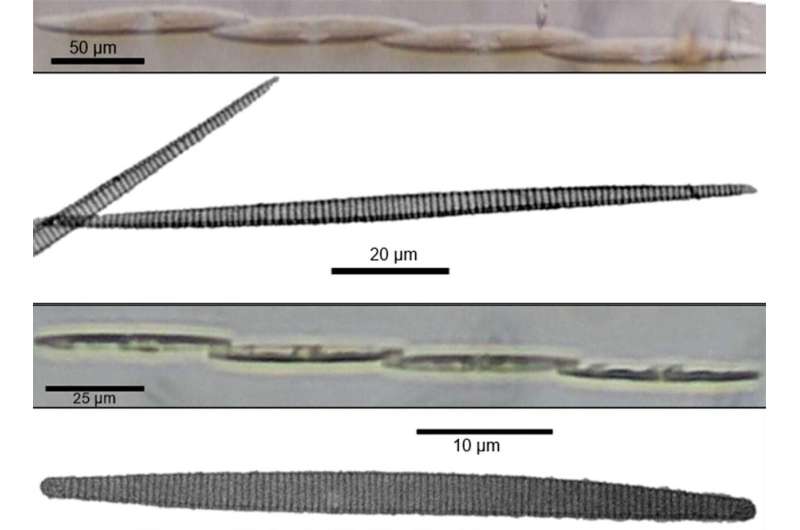 Amnesia-causing diatoms found in Luzon shellfish farms